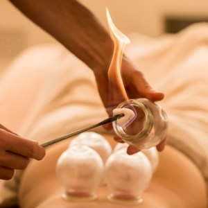 soin-therapie_ventouses_cupping-therapy_500px_001